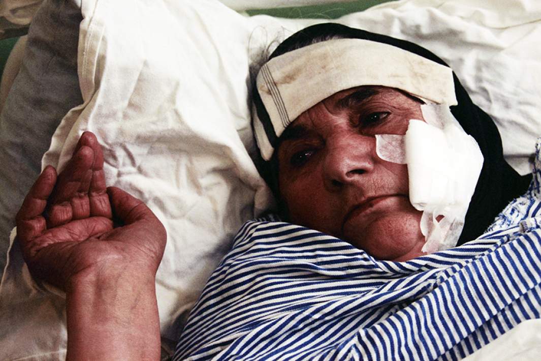 Жительница города Сурдулица Даринка Кнекович, пострадавшая от бомбардировки. 28 апреля 1999 года