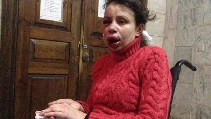 Обвиняемый в нападении на активистку майдана получил убежище в России