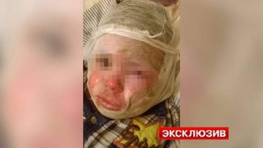 В Ульяновске коллектор из-за долга деда поджег его двухлетнего внука