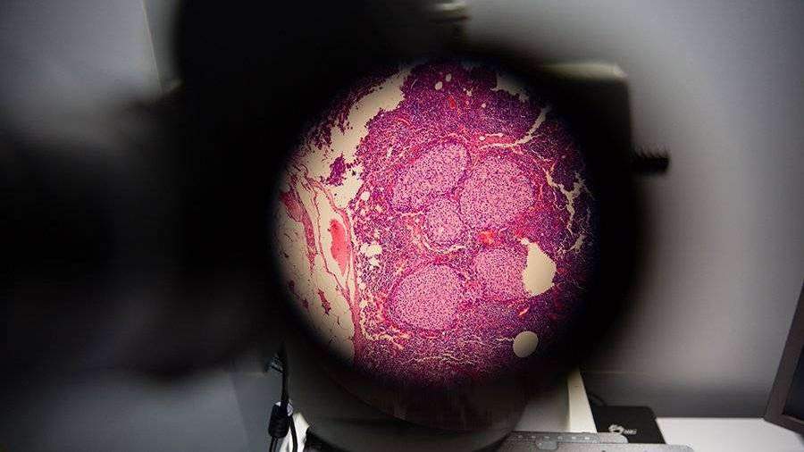 Ученые нашли понижающие чувствительность рака к радиофармтерапии мутации
