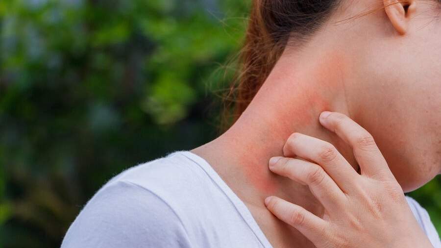 Rheumatologist explained the high incidence of lupus among women