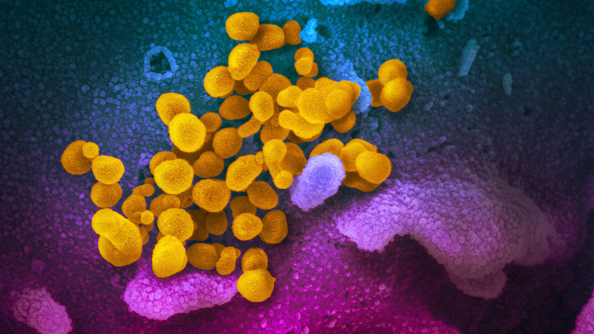 Коронавирус: поверхности, которые сами убивают микробы