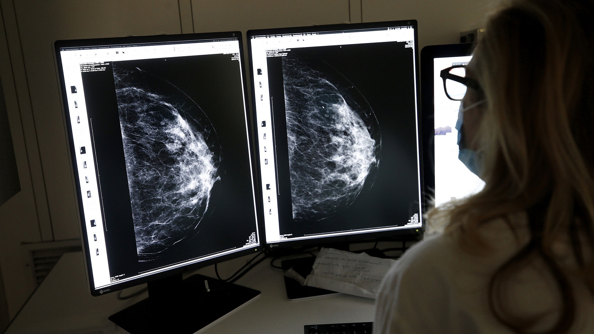 Рак молочной железы — первые признаки и симптомы, лечение рака груди в Москве