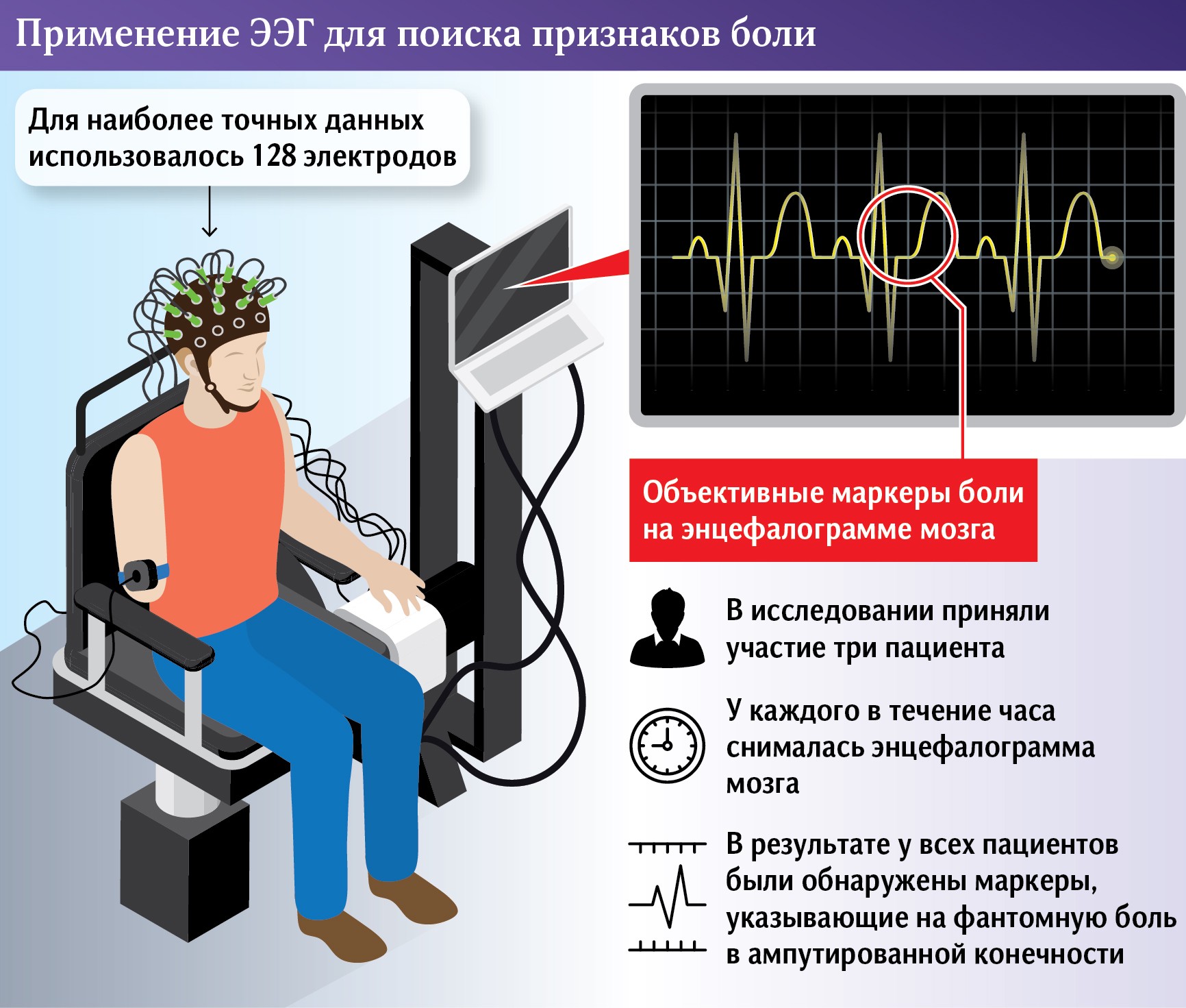 Нервный взрыв: российские ученые нашли сигнал боли в мозге | Статьи |  Известия