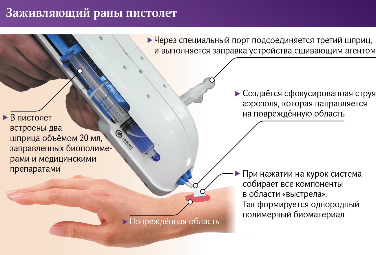 Защитное прикрытие: в России создали заживляющий раны пистолет | Статьи |  Известия