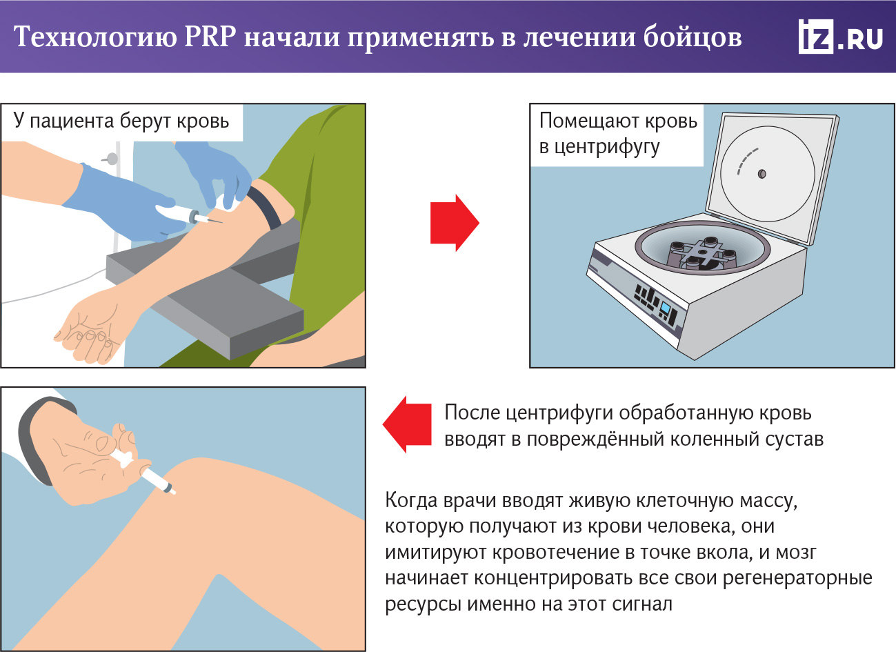 Cortexil PRP: что это за технология