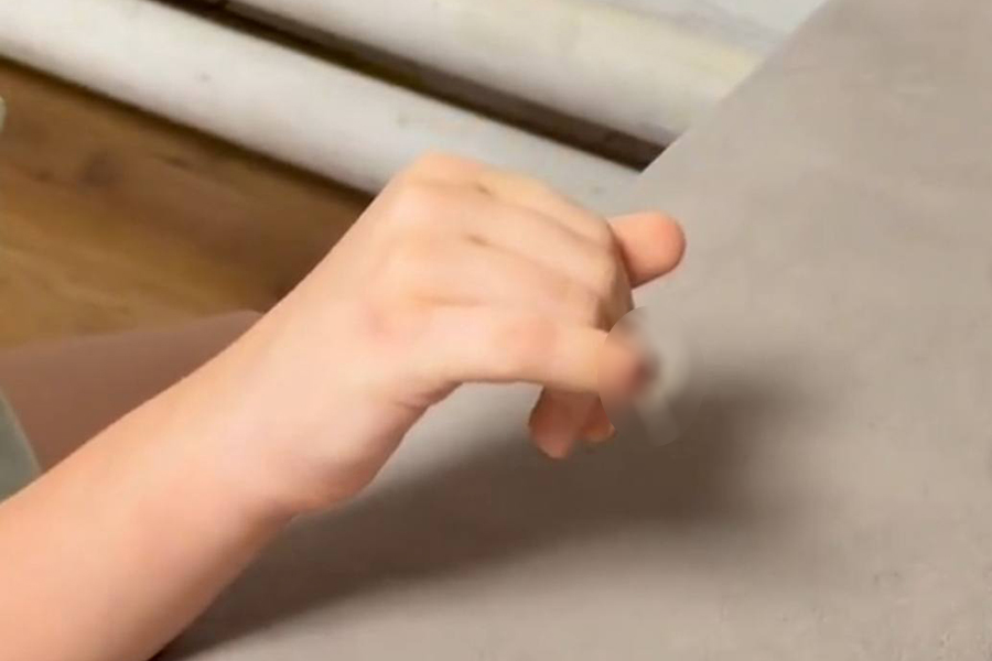 Последствия травмы пальца 