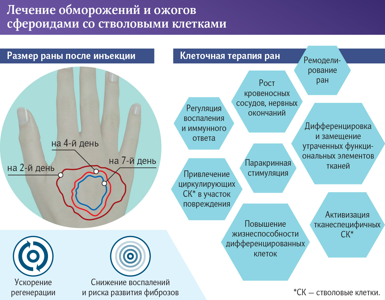 Лечение обморожений