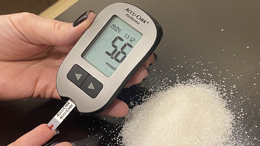 Ученые объяснили связь между сахаром и камнями в почках