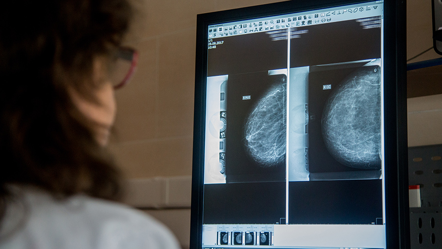 Маммолог оценил эффективность сделанной Анджелиной Джоли операции