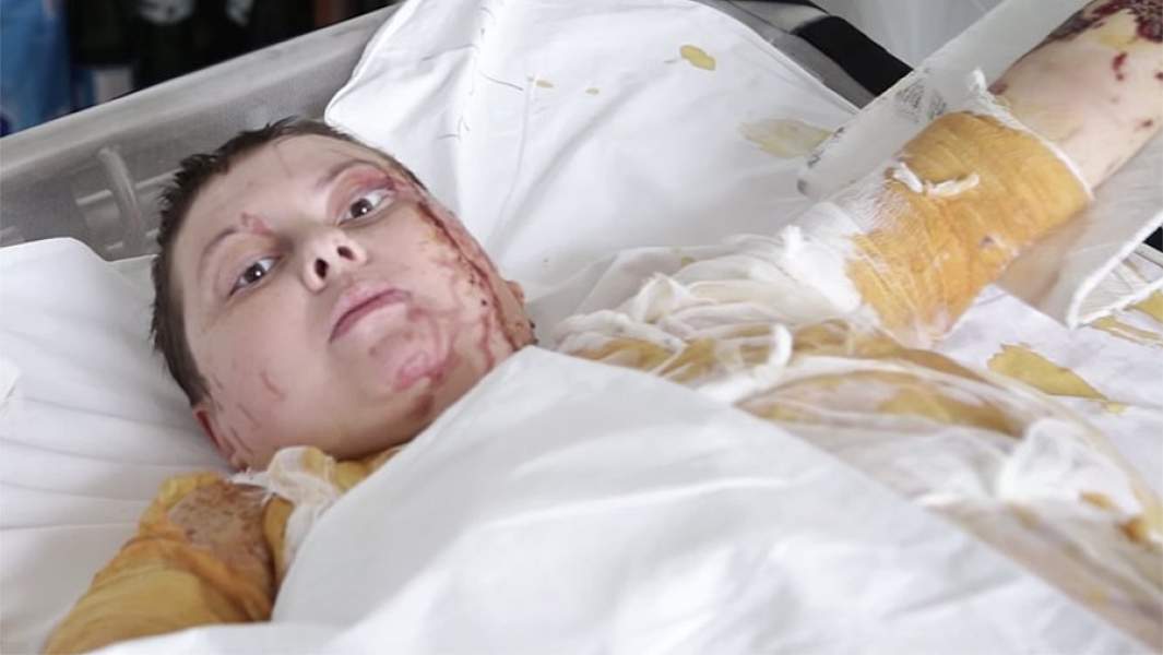 Екатерина Гандзюк в больнице после покушения