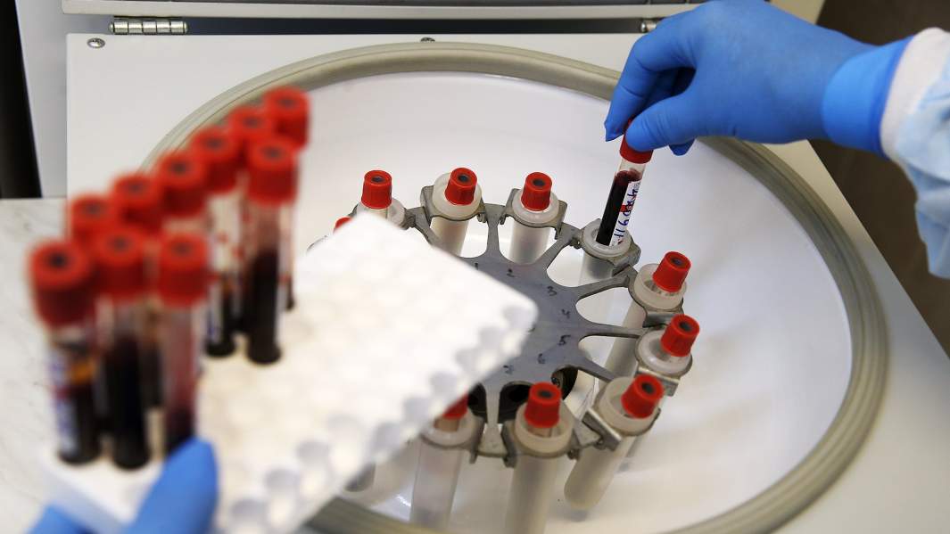 лаборатория профилактика спид