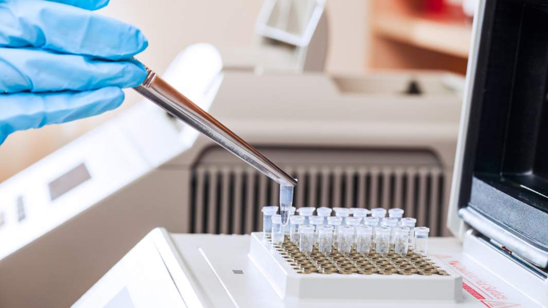 Загрузка образцов ДНК для ПЦР