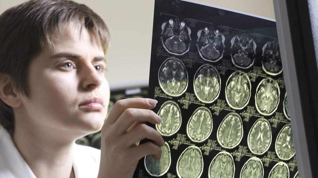 Врач анализирует компьютерную томографию 