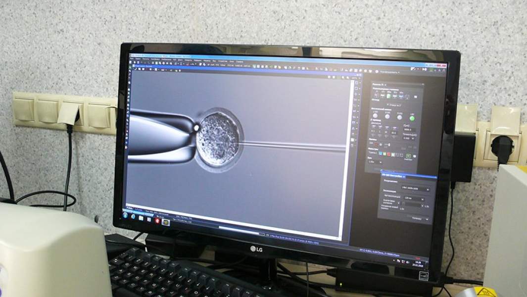 Яйцеклетку протыкают капилляром и вводят раствор РНК для геномного редактирования