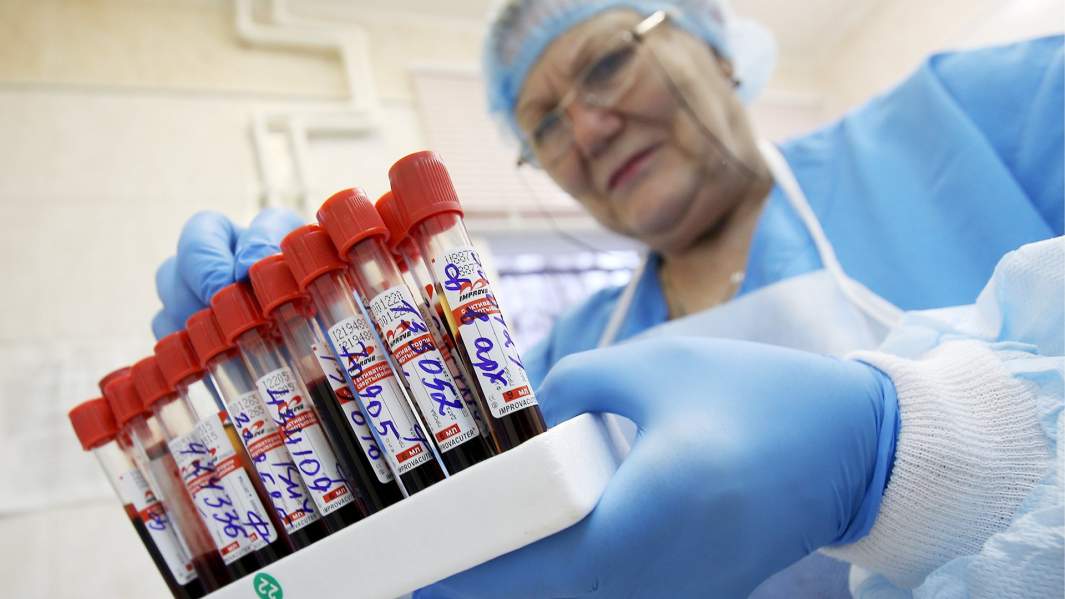 В лаборатории по профилактике и борьбе со СПИДом и инфекционными заболеваниями