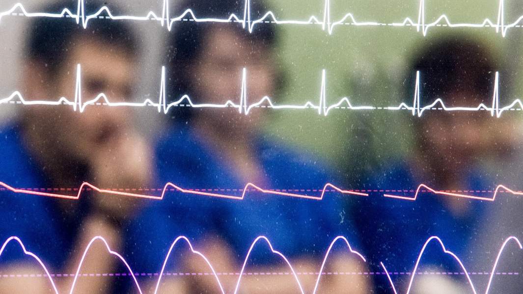 кардиограмма