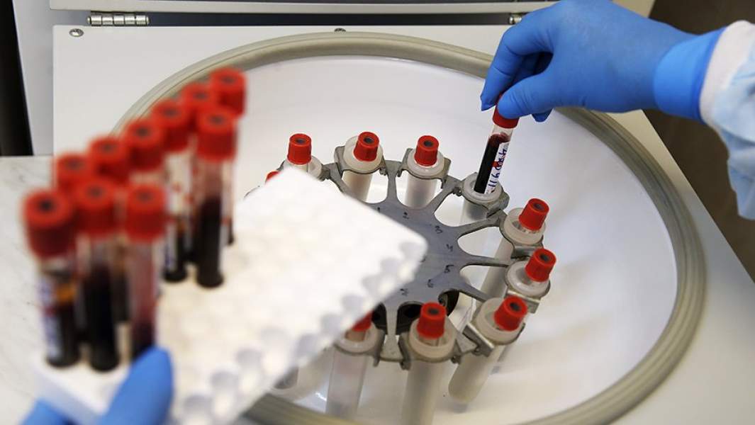 вич пробирка анализы кровь