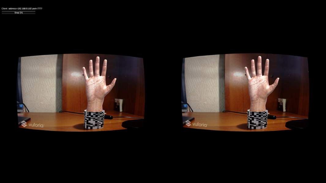 Вариант созданной модели, которую впоследствии видит пациент, проходя терапию