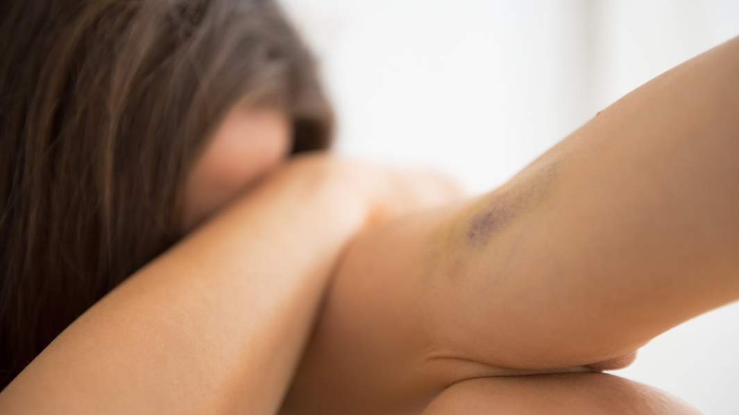 Девушка-наркоманка