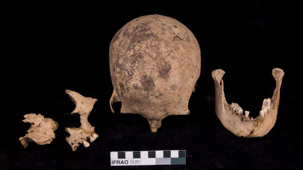 Один из черепов коллекции Кунсткамеры