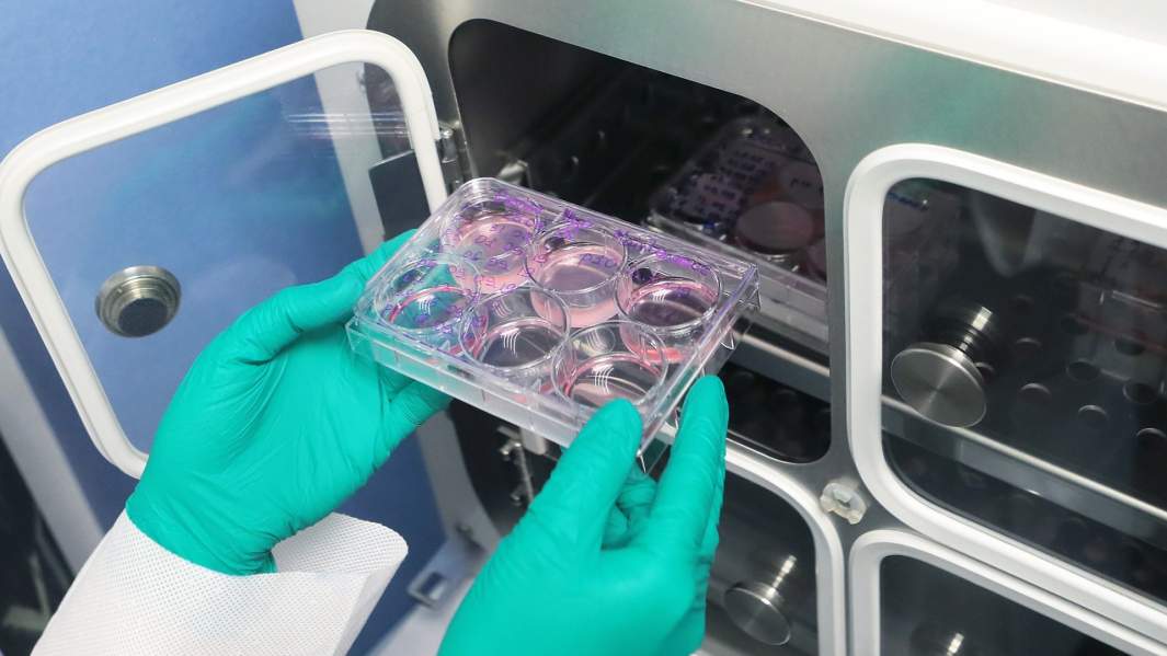 Гель с образцом мышечной ткани