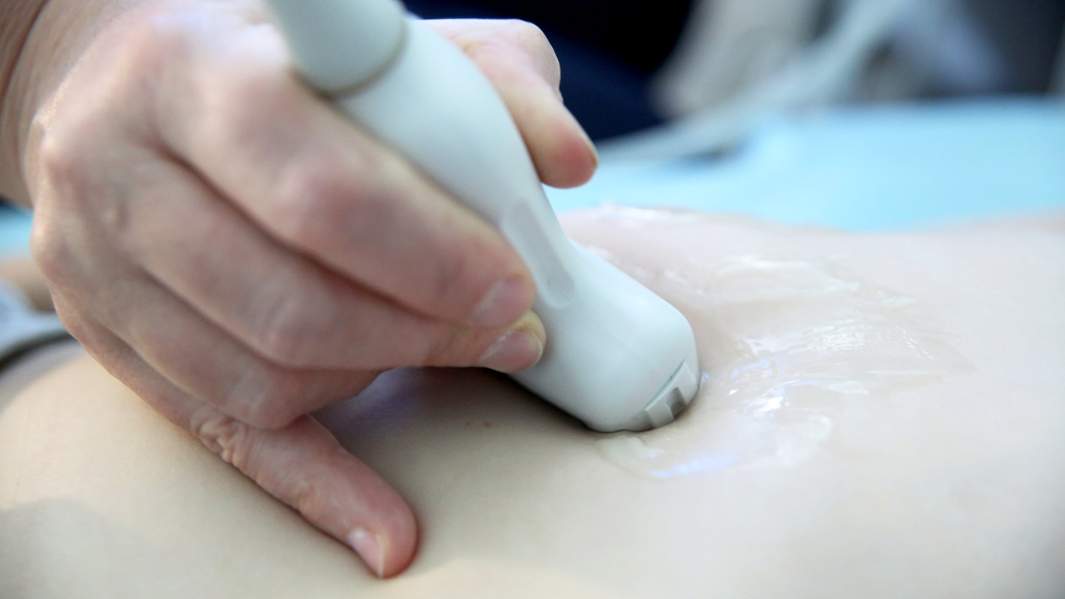 Специалист проводит ультразвуковое исследование