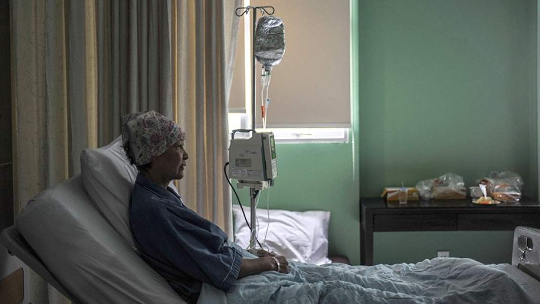 химиотерапия