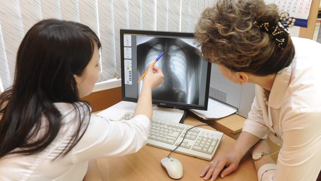 рентген легких