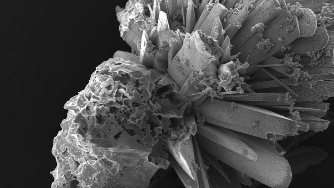 Микроструктура неорганической составляющей синтетического материала для тканевой инженерии. Материал синтезирован на МКС с помощью биопринтера «Орган.Авт»