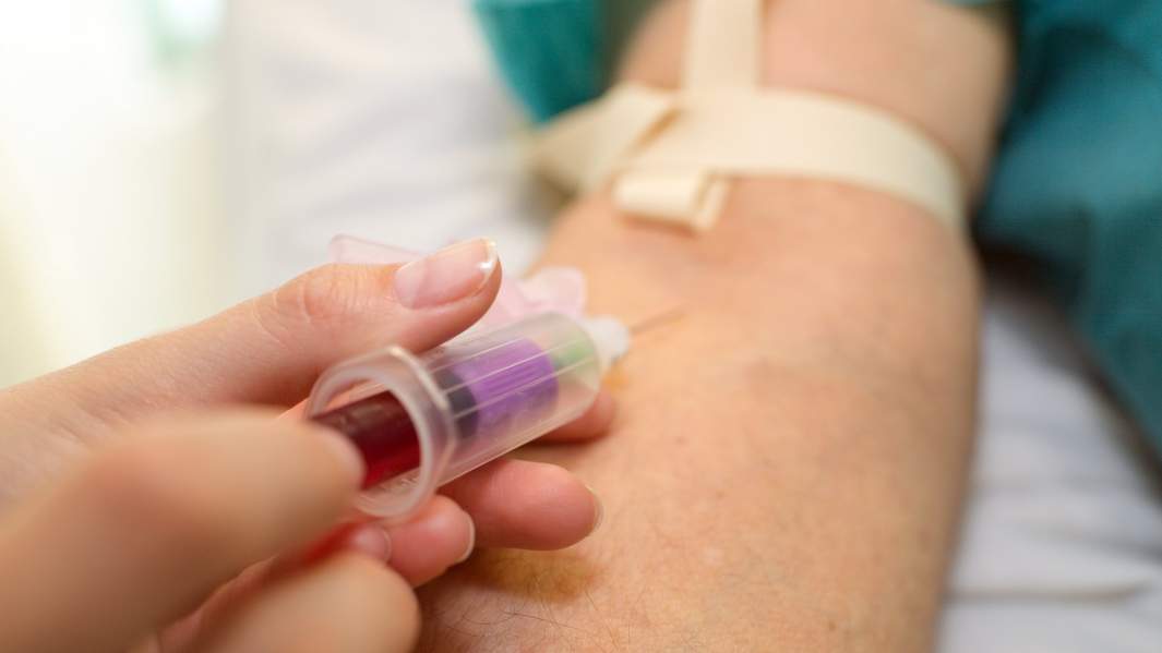 Плюс один: ученые впервые за 19 лет открыли новый штамм ВИЧ