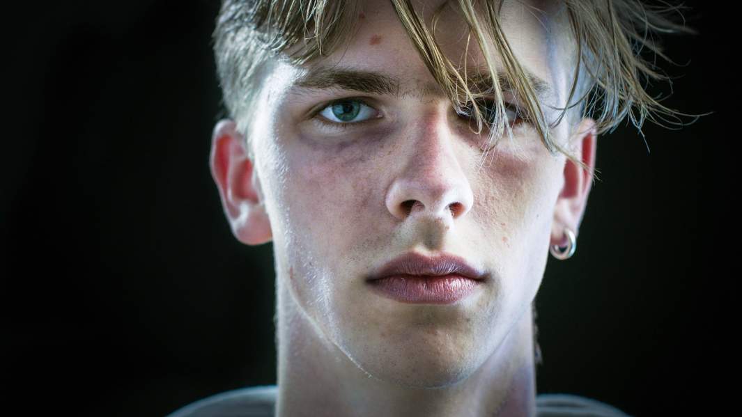 Избитый парень