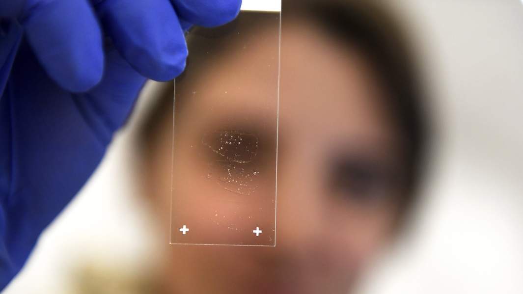 Стволовые клетки, полученные из мышц человека