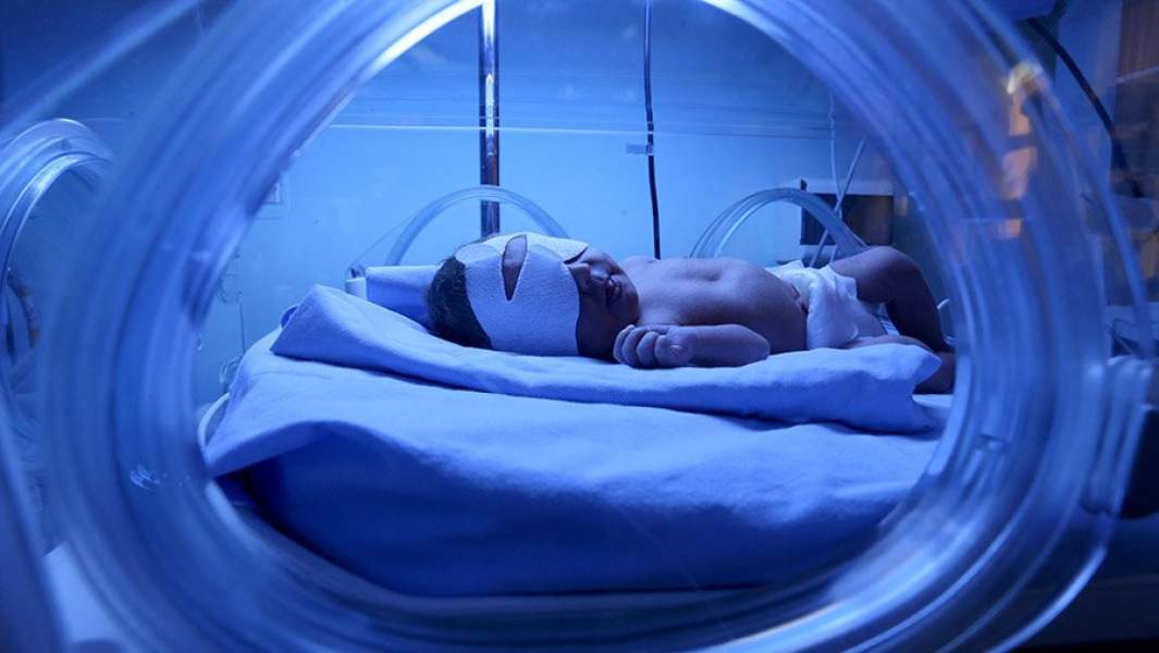 Новорожденный в палате интенсивной терапии