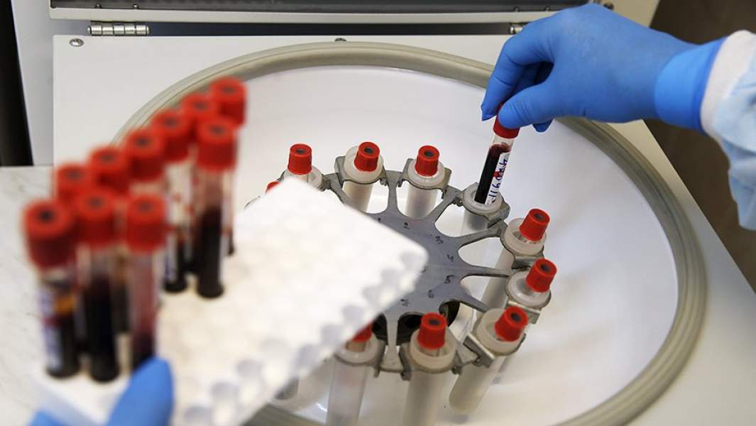 вич кровь лаборатория тест