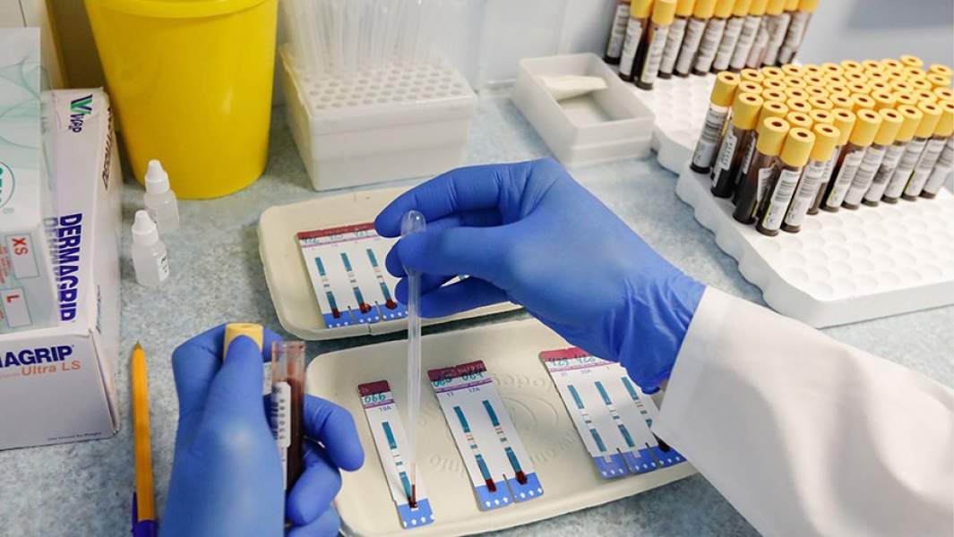 «К 35 годам 3-4% мужчин инфицированы ВИЧ»