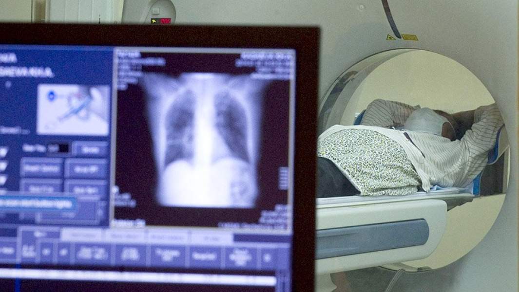 томография грудной клетки