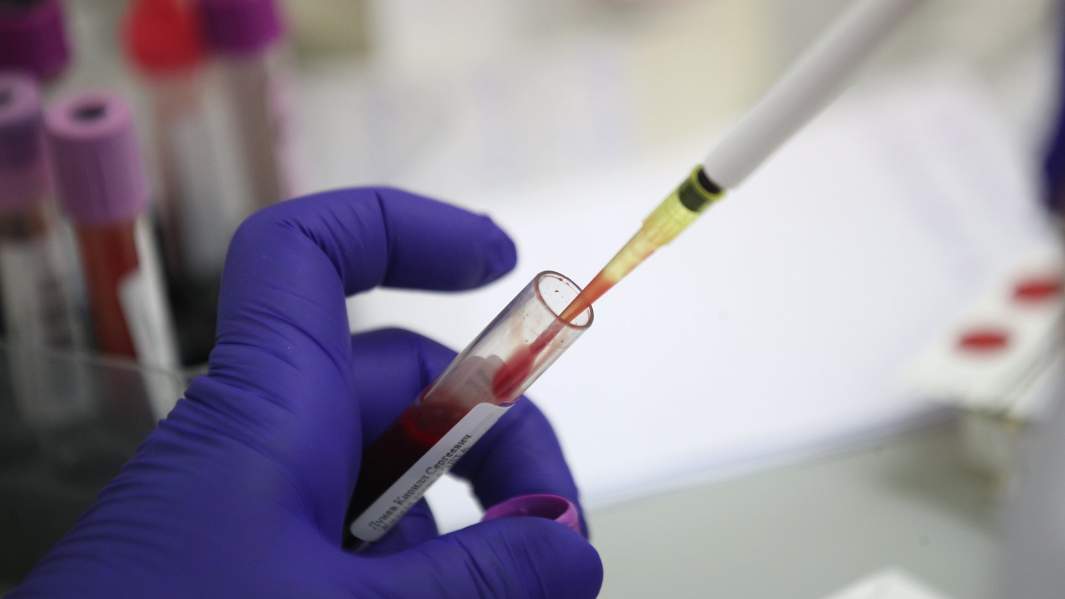 анализ крови