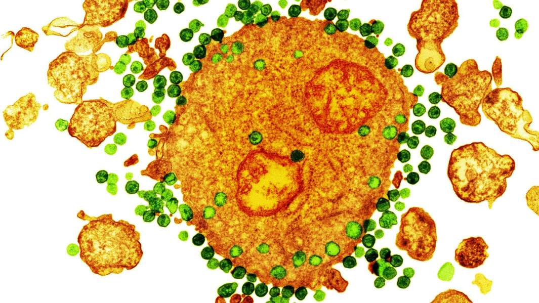 вич клетка наука