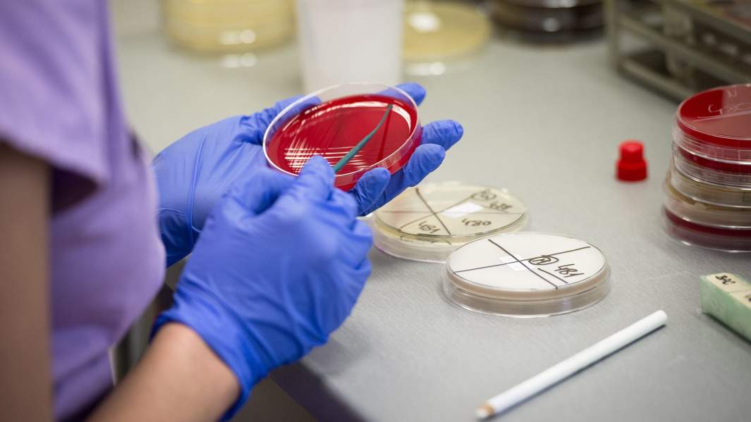 Тест на выявление коронавируса в пражской лаборатории