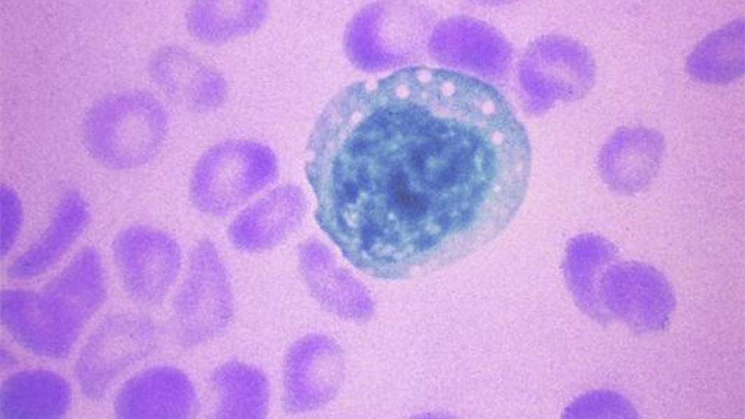 хантавирус