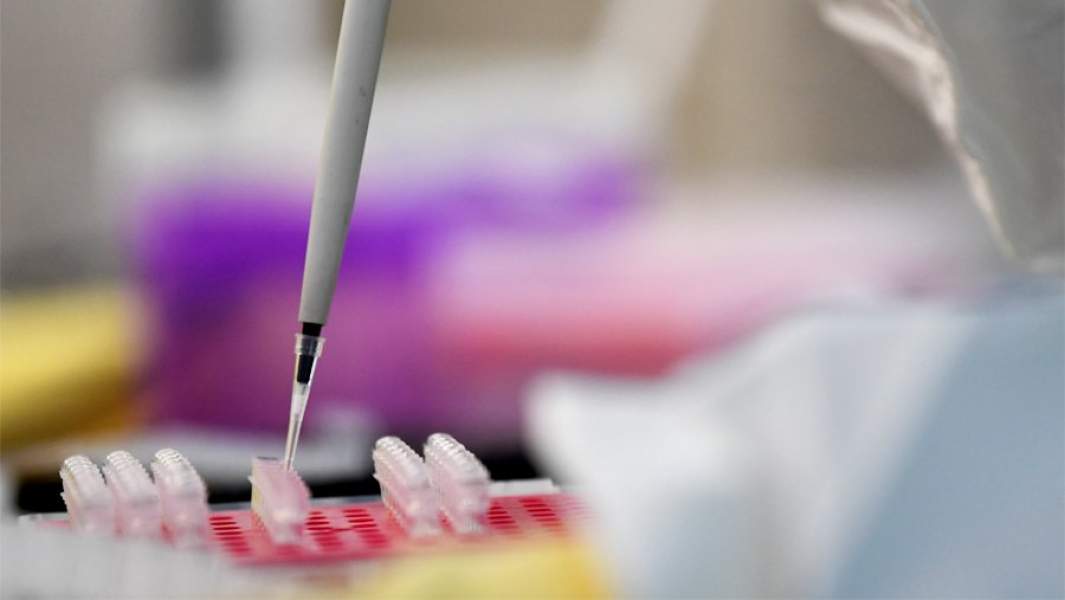 исследование