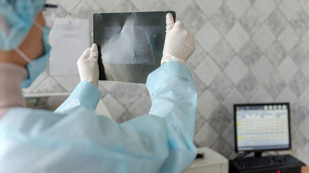 снимок короновирус