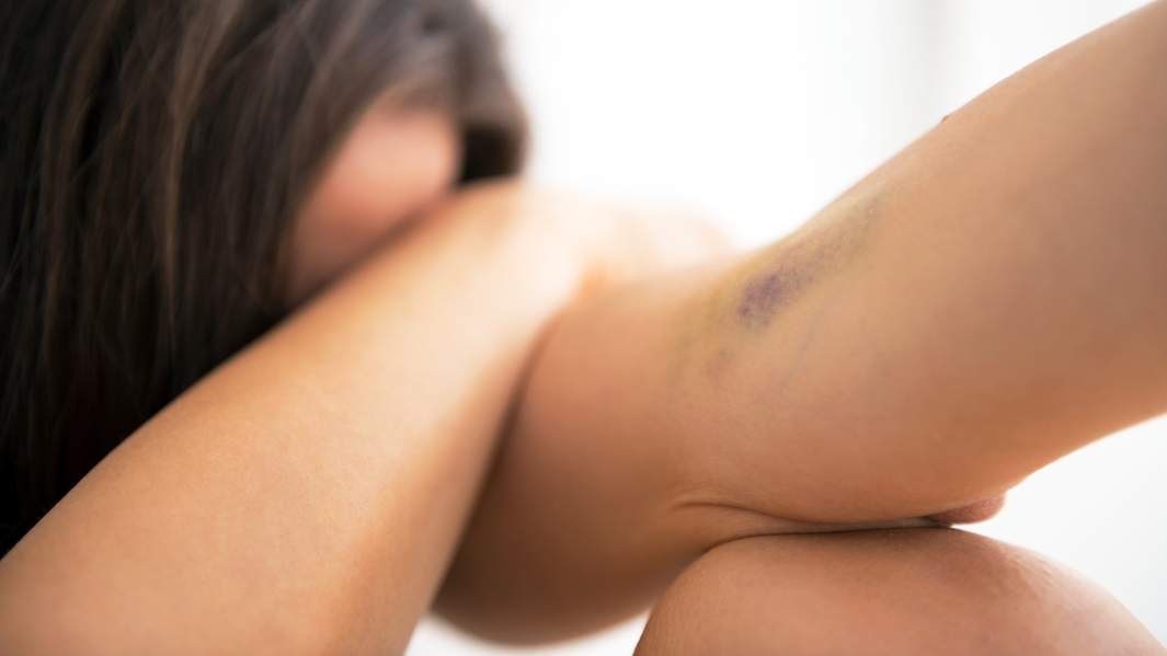 Наркоманка