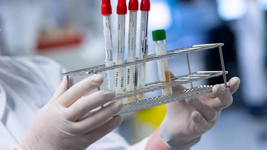 Тест на коронавирус 