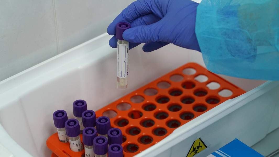 Пробирки в лаборатории