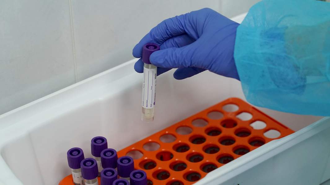 вирус лаборатория 