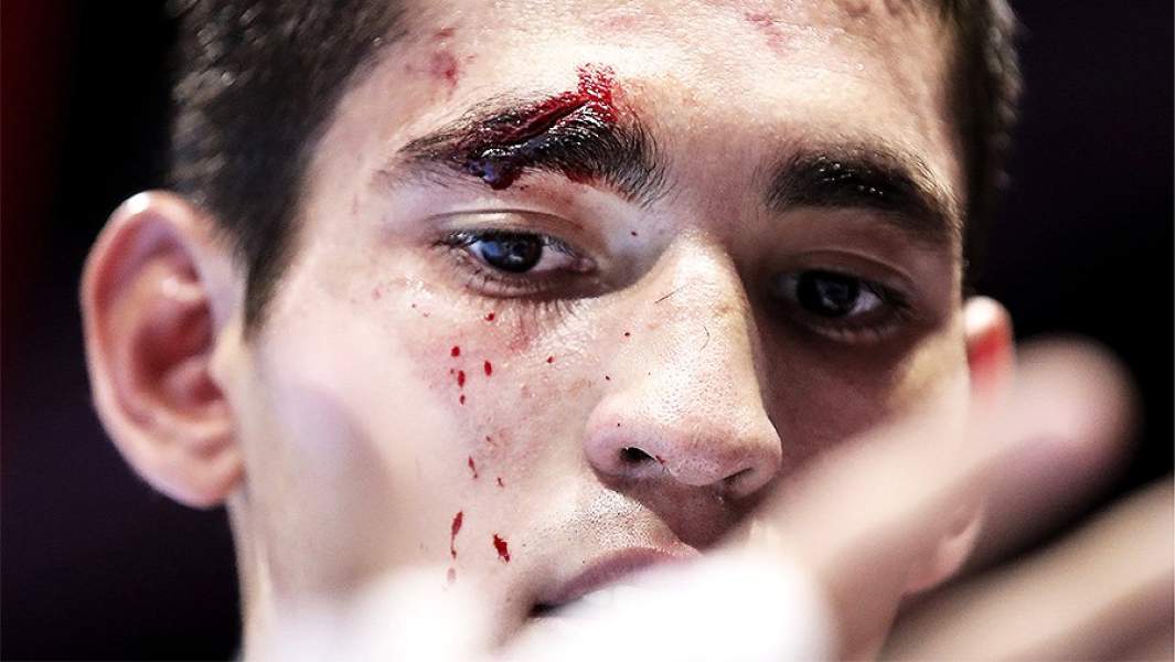 альберт батыргазиев