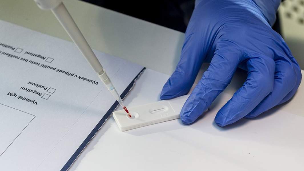 Тест на антитела