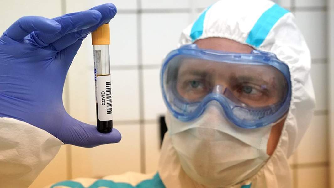 Тест на антитела к коронавирусу